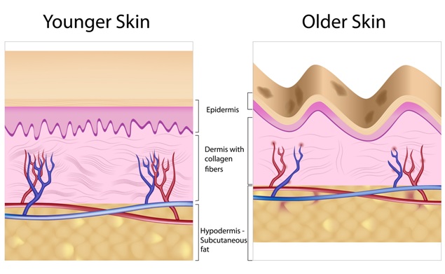 年輕老化肌膚比較圖.jpg