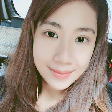 玻尿酸填補 玻尿酸豐臉 雅丰診所微整形案例angel 玻尿酸術後分享照二