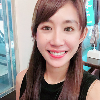 玻尿酸填補 玻尿酸豐臉 雅丰診所微整形案例angel 玻尿酸術後分享照五
