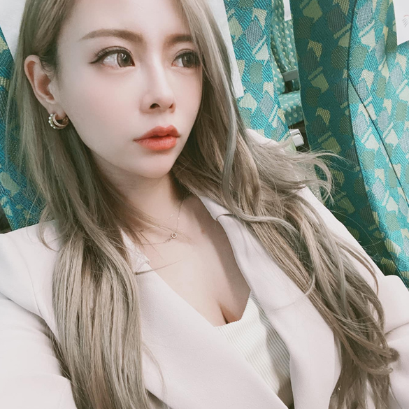 魔滴隆乳 Motiva隆乳 雅丰產後隆乳 案例寶咩 隆乳術後照分享三