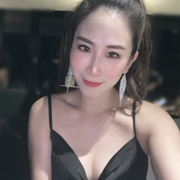 LINDA威塑抽脂+抽脂補臉+抽脂豐胸術後分享05