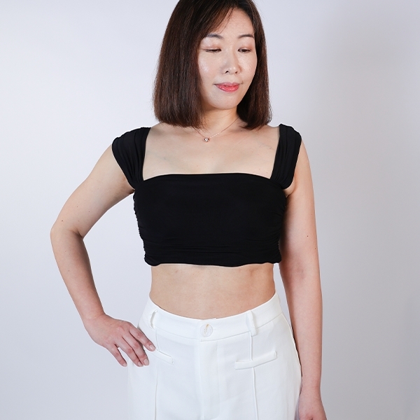 雅丰抽脂電漿案例術後生活照kathy03