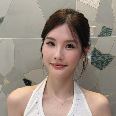 雅丰絲漾FUE免剃髮髮縫明顯案例,黃智威醫師,04