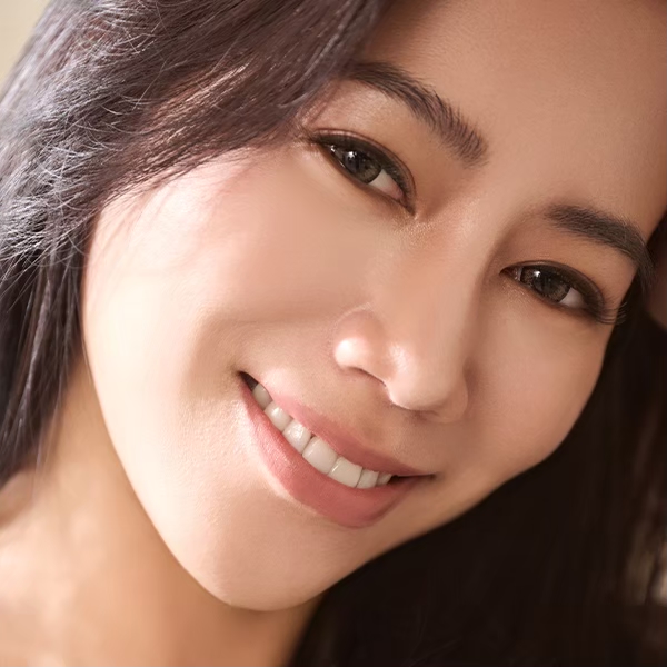貴族隆鼻術後生活照04,3D列印隆鼻,FITME,雅丰時尚診所