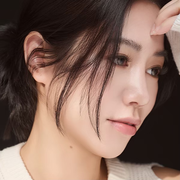 貴族隆鼻術後生活照02,3D列印隆鼻,FITME,雅丰時尚診所