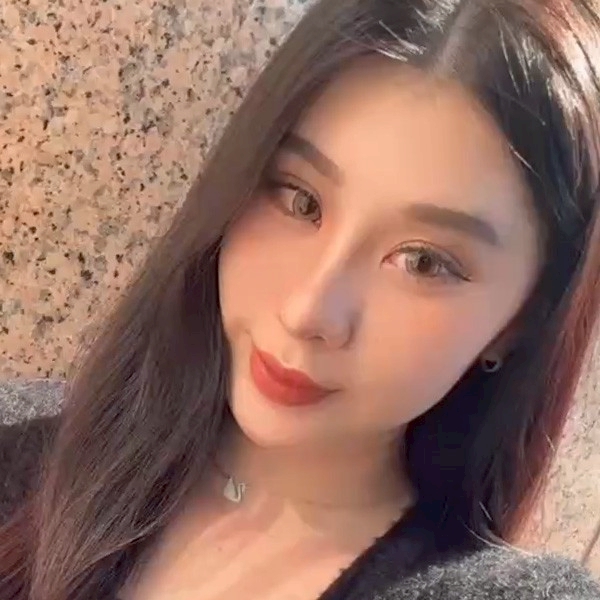 YUNA隆鼻心得分享, 隆鼻術後生活照02