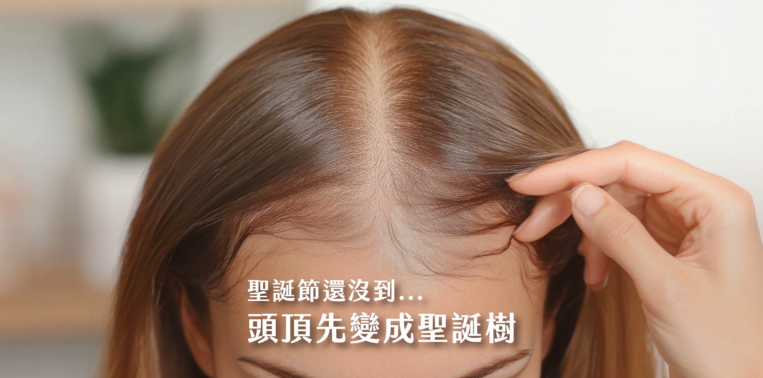 女性雄性禿頭頂上的聖誕樹?| 整形外科黃智威院長
