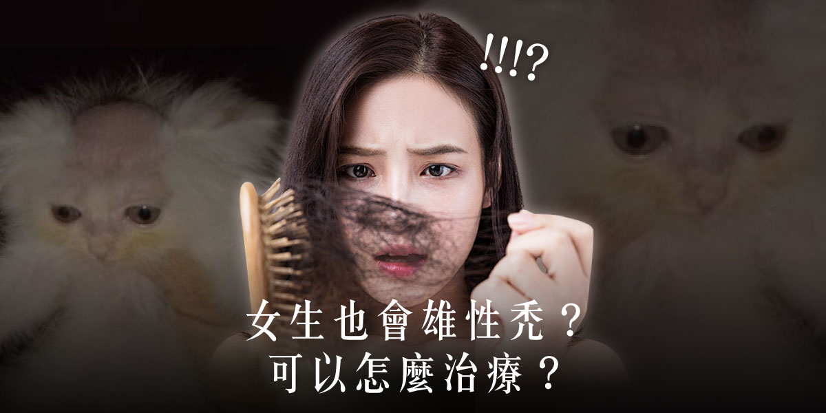 女生也會雄性禿?可以怎麼治療?