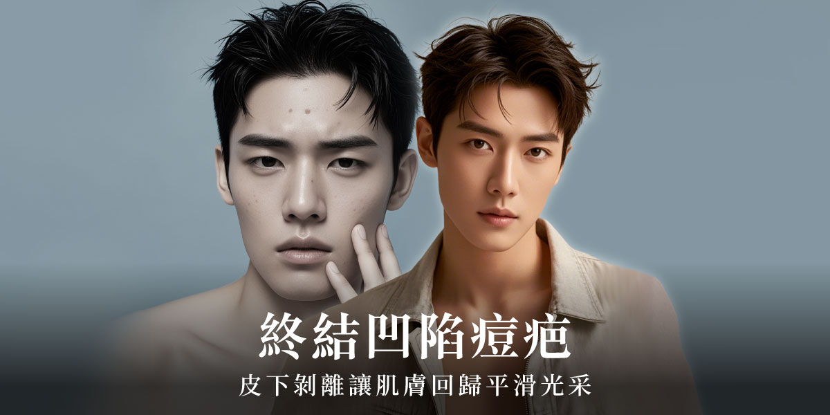 皮下剝離讓肌膚回歸平滑光采!皮膚專科毛奕甯醫師 | 雅丰麗緻美膚診所