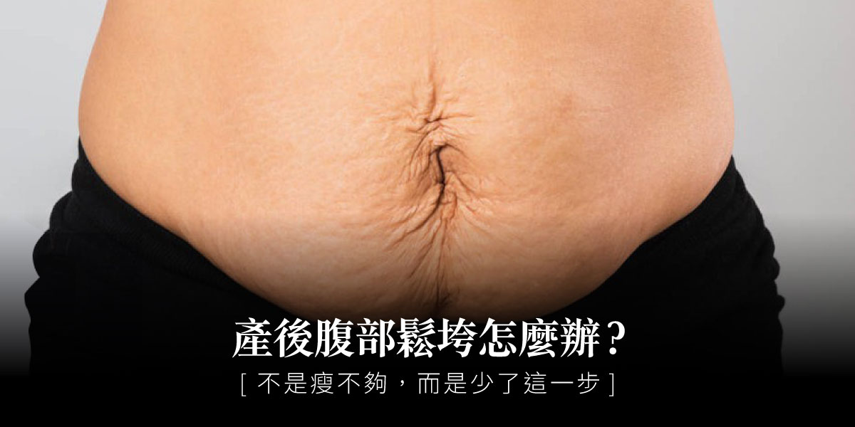 產後腹部鬆垮怎麼辦?不是瘦不夠,而是少了這一步。整形外科余宗宸醫師│雅丰席睿診所
