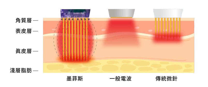 墨菲斯_其他比較