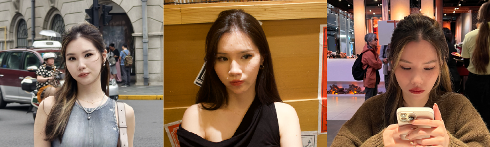 【FUE微創免剃髮】「美人尖禿頭、分線明顯」怎麼救！從髮縫明顯到髮量重生的改變_術前