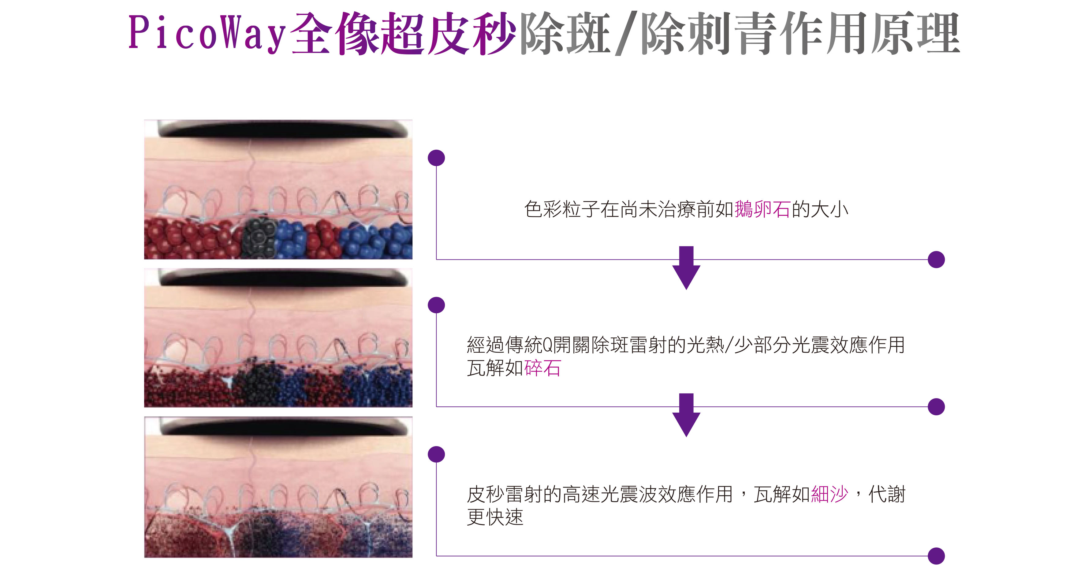 美國原廠PicoWay皮秒雷射05