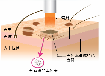 日式光纖美白-作用原理01