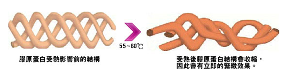 CPT電波拉皮-膠原蛋白結構變化