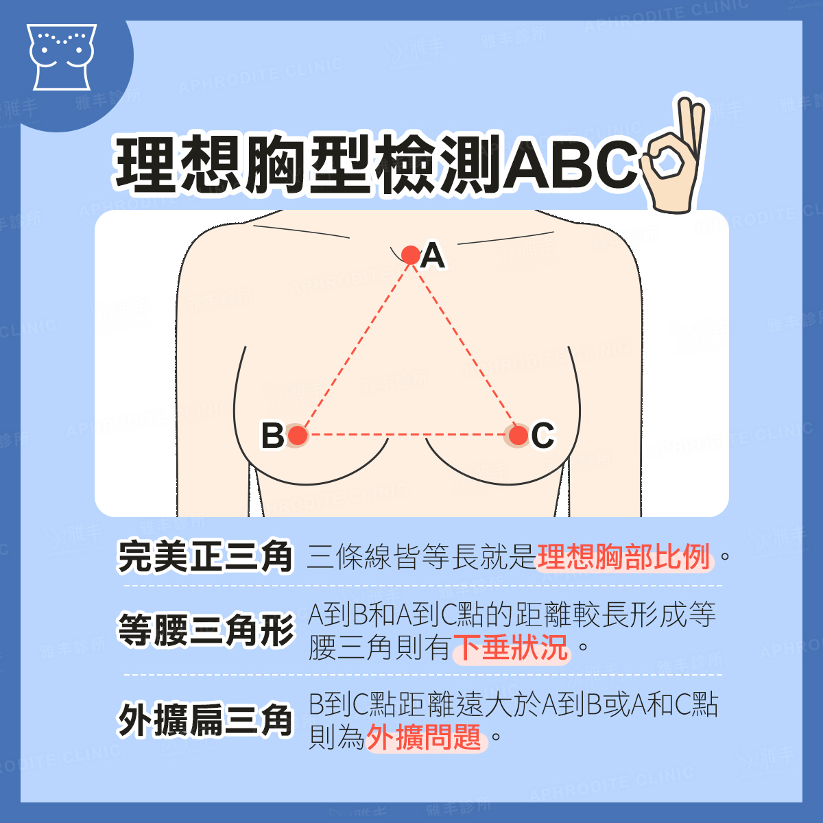 理想胸型,雅丰診所,雅丰隆乳