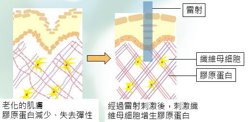 日式光纖美白作用原理03