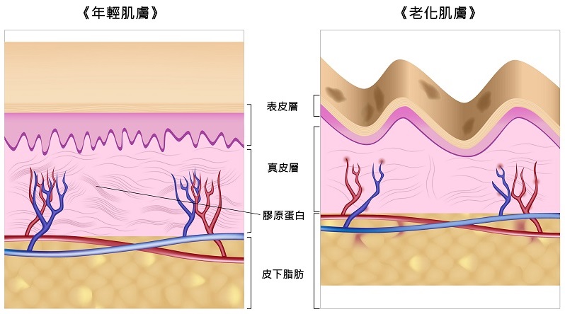 Utims沃緹音波拉皮-肌膚構造圖