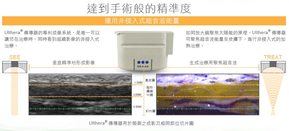 Ulthera極線音波拉皮-治療深度區域剖面圖