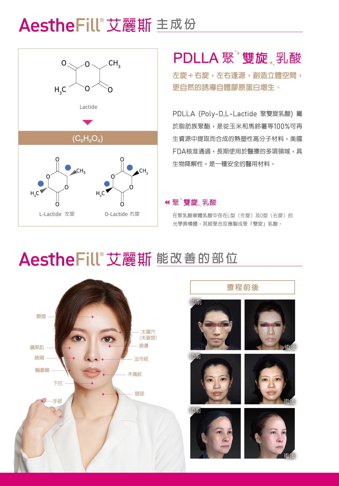 艾麗斯,童顏針,精靈針,成分,適合部位
