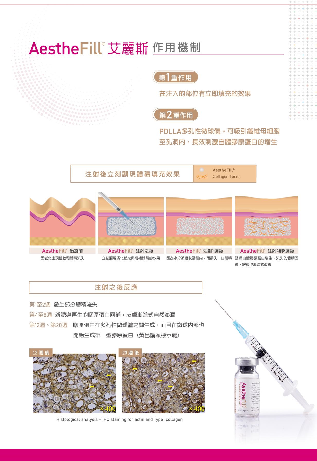 艾麗斯,童顏針,精靈針,成分,作用機制