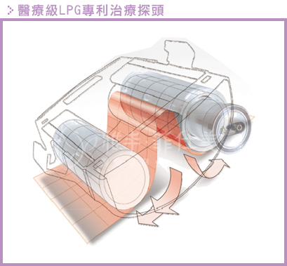 LPG探頭