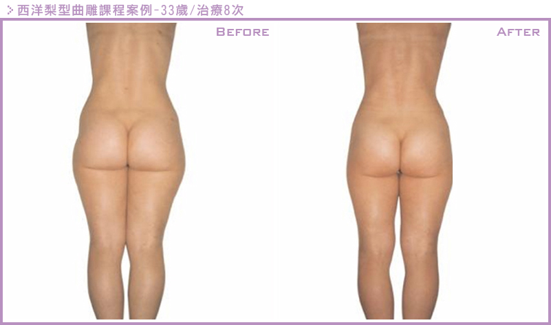 LPG雕塑案例2