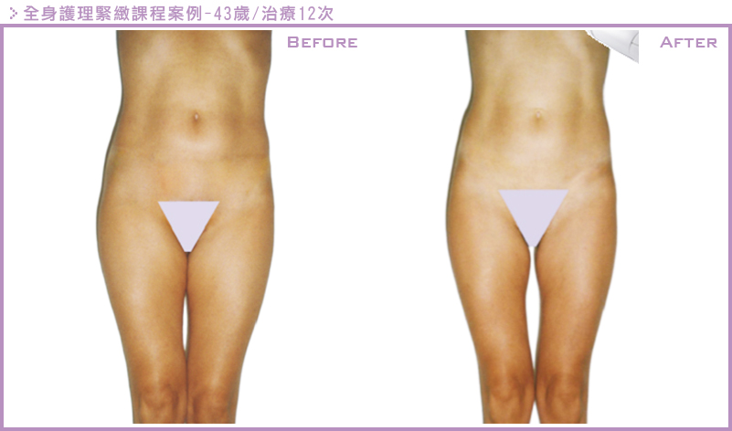 LPG雕塑案例3