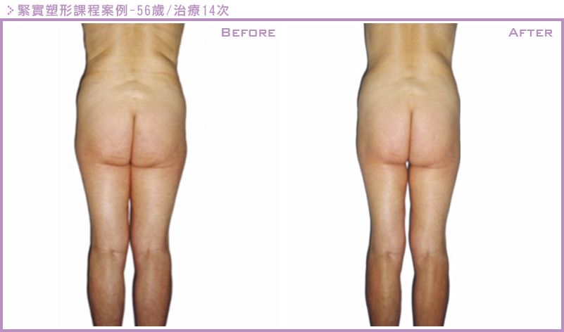 LPG雕塑案例4