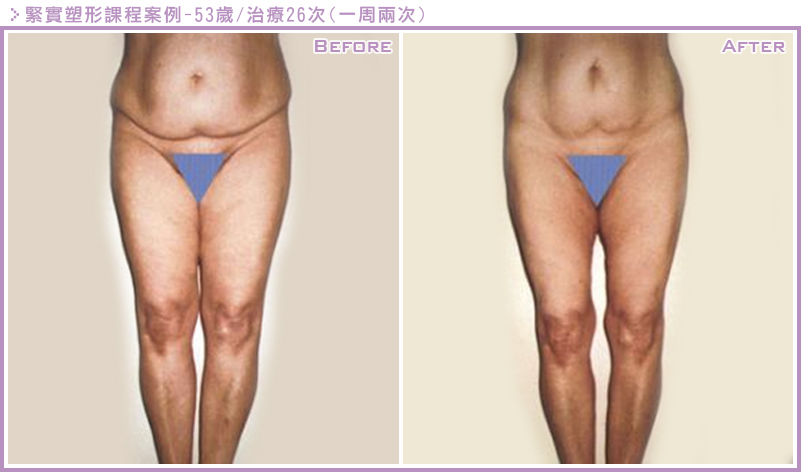 LPG雕塑案例5