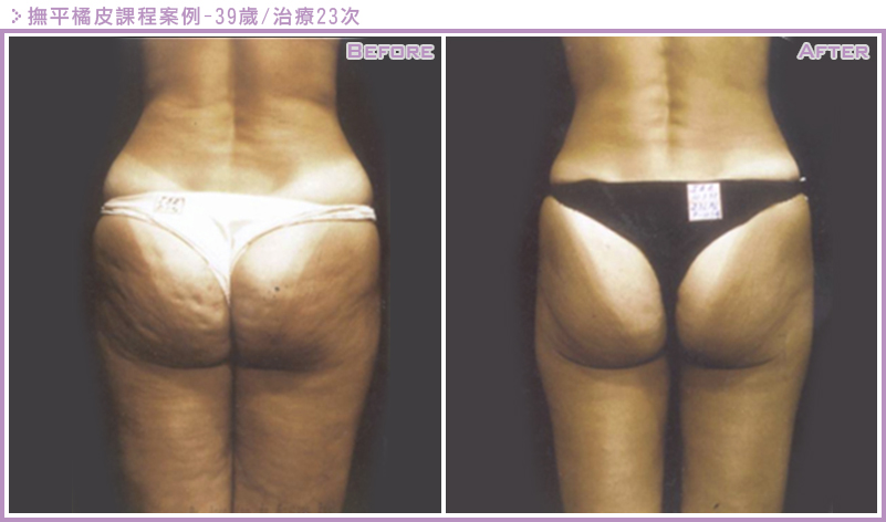 LPG雕塑案例6