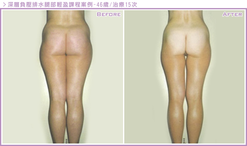 LPG雕塑案例7