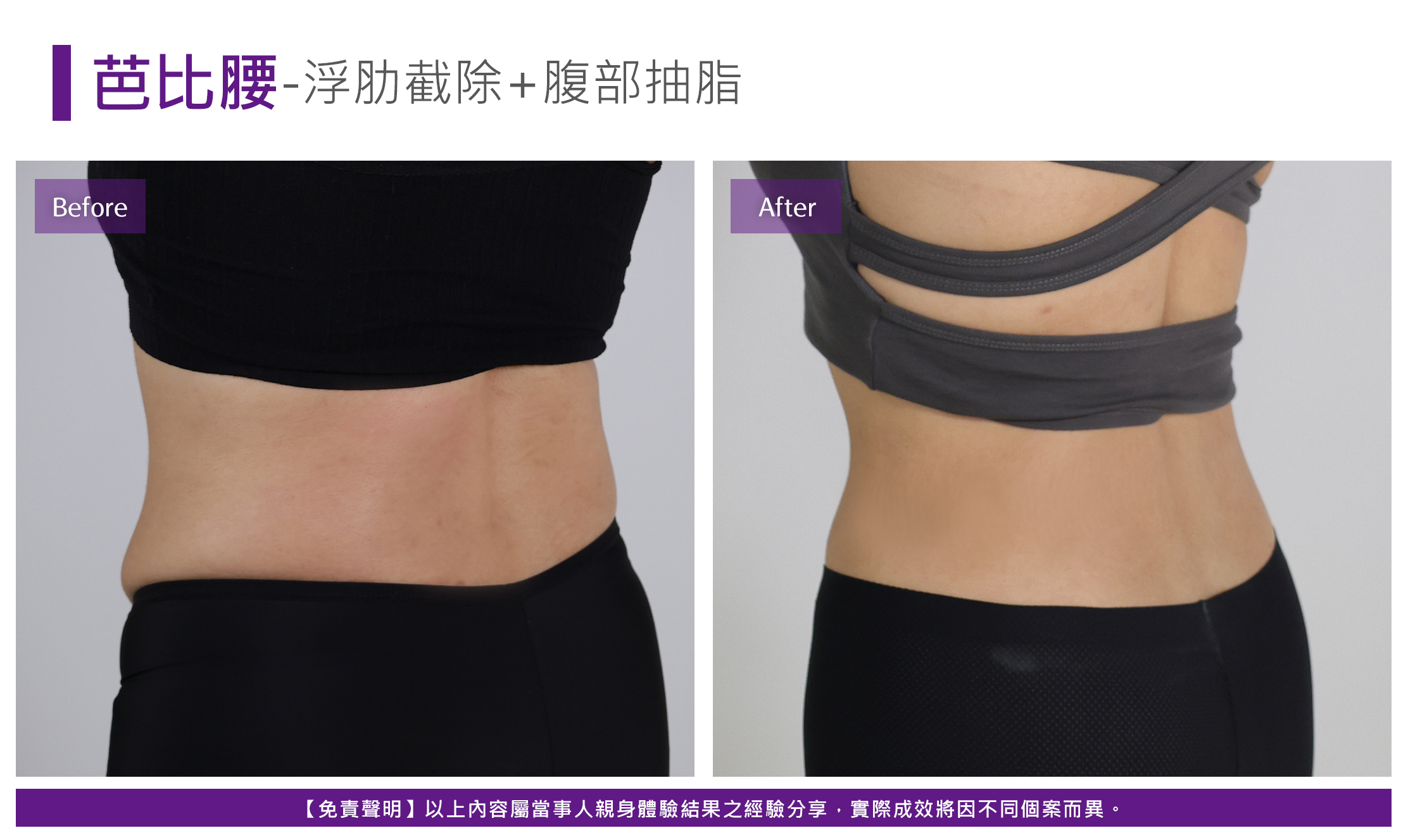 芭比腰案例