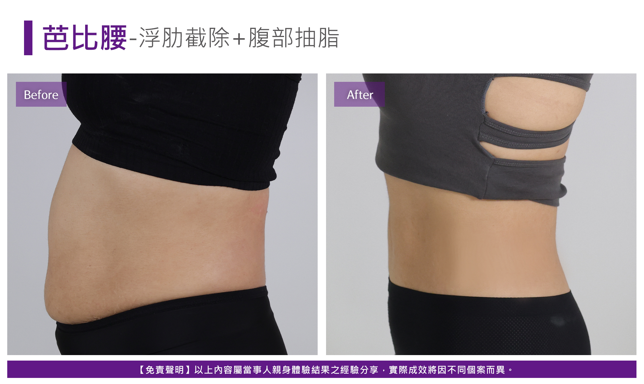 芭比腰案例
