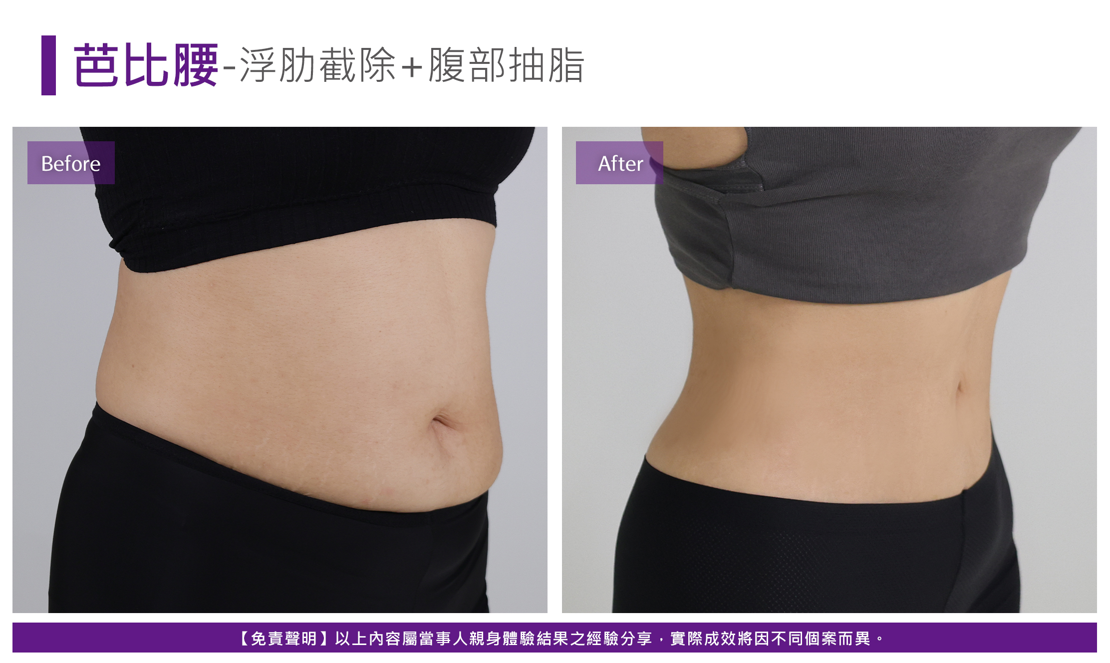 芭比腰案例