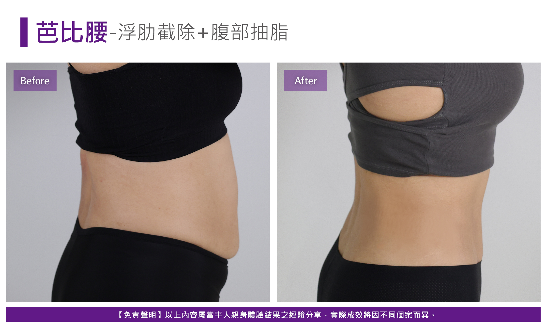 芭比腰案例