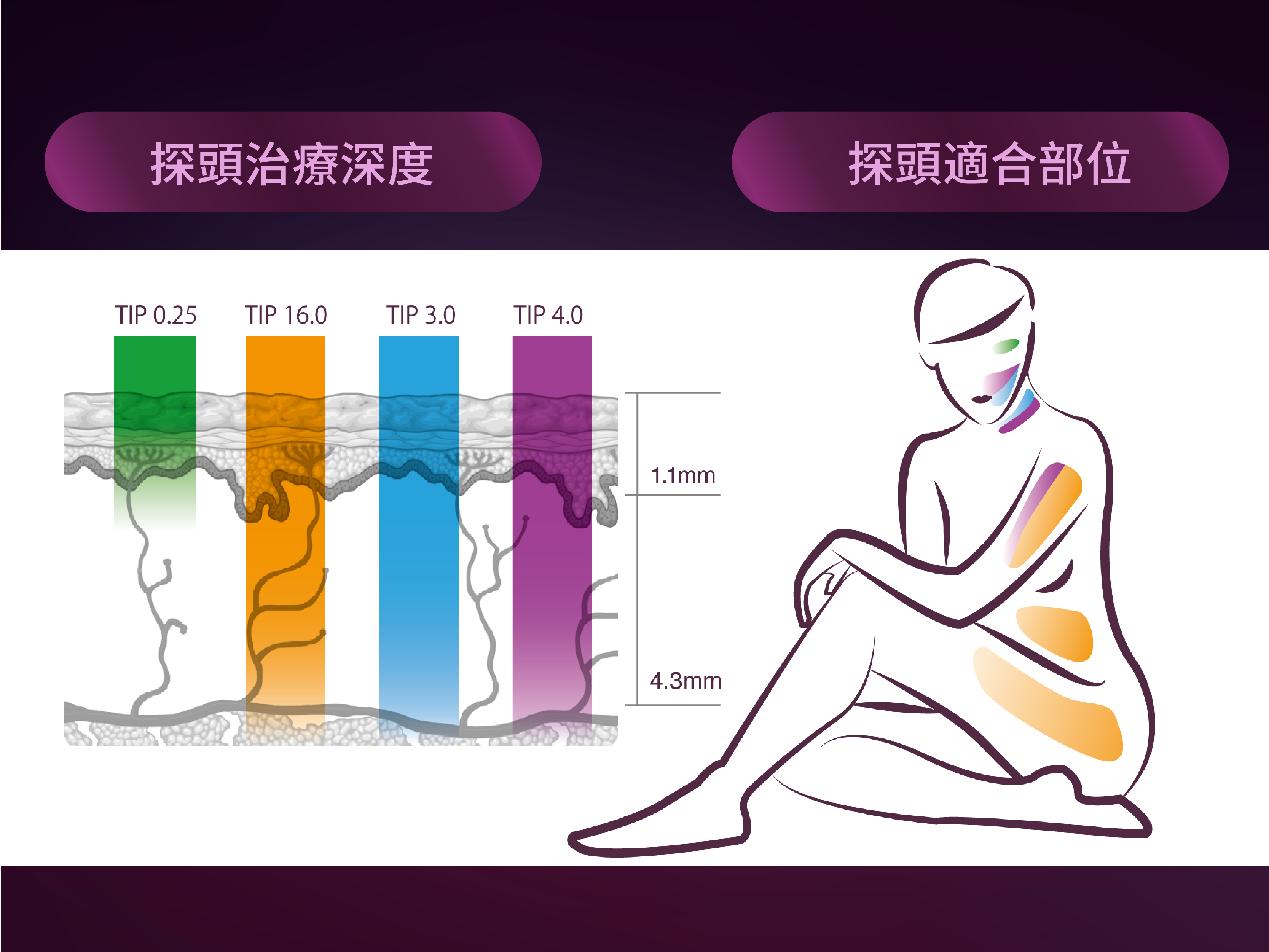 雅豐-新一代Thermage FLX鳳凰電波波吸收吸收&治療