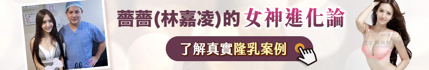banner_隆乳成功案例