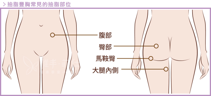 抽脂豐胸常見抽脂位置