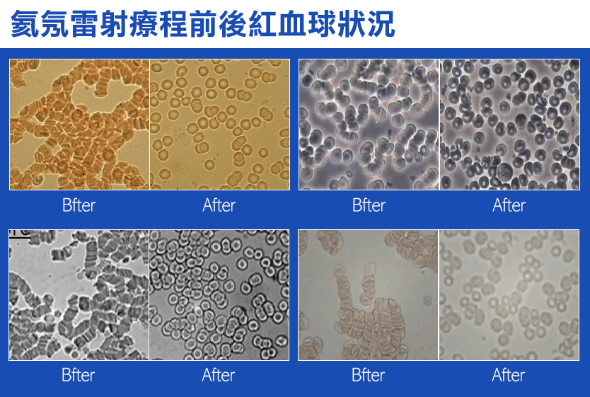 氦氖雷射療程前後紅血球狀況