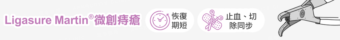 超音波刀微創痔瘡