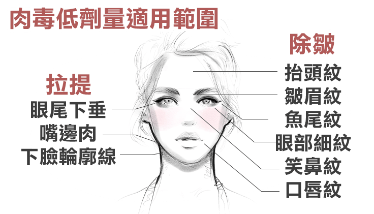 肉毒桿菌, 低劑量, 除皺, BOTOX, letybo