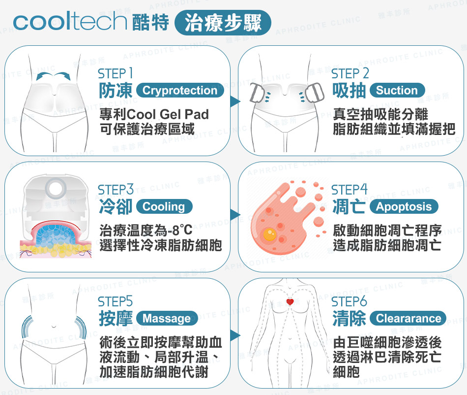 cooltech酷特治療流程