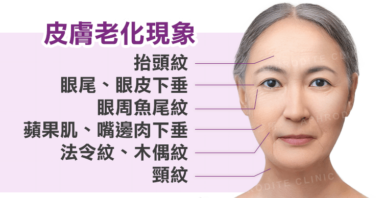 皮膚常見的老化現象,鳳凰電波改善老化,緊緻肌膚