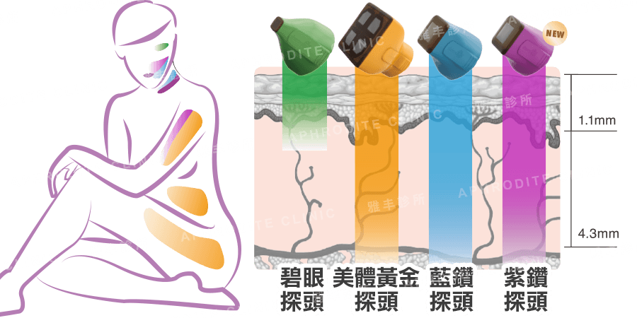 鳳凰電波探頭深度,紫鑽探頭,藍鑽探頭,碧眼探頭,美體黃金探頭