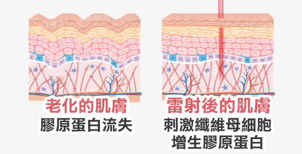 年輕肌膚和治療後的肌膚