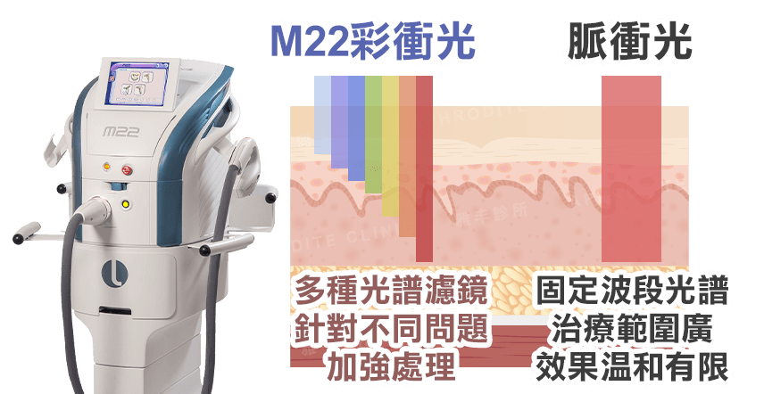M22彩衝光雨一般脈衝光比較,多種濾鏡
