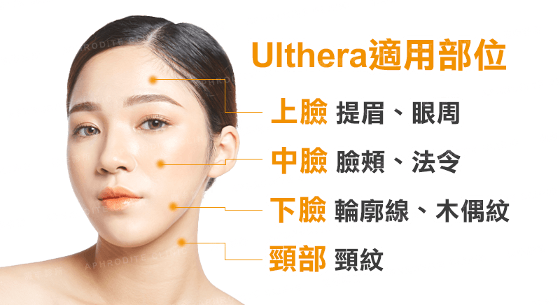 Ulthera美國音波拉提適用範圍