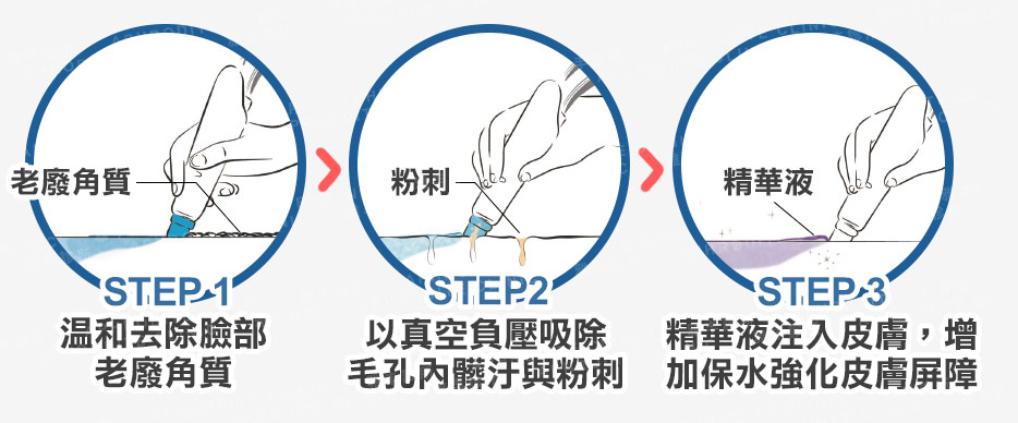 海菲秀療程三步驟