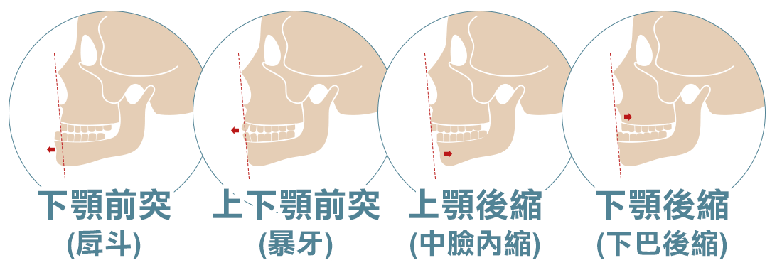 常見臉型問題